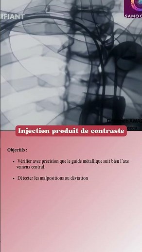 POSE DE PAC ➡️ Injection de produit de contraste