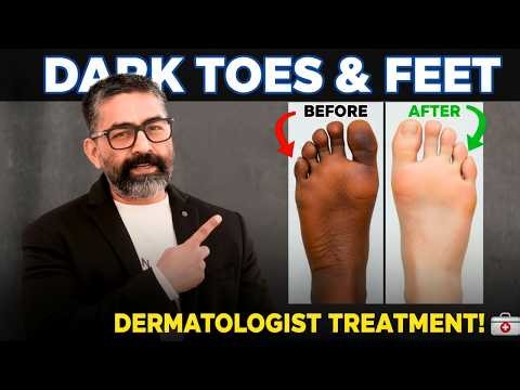 Say GOODBYE to Dark Toes , Feet And Knuckles with This Simple Trick By Dermatologist