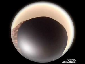 Farting on command 47