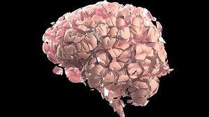 Brain Explosion Headache Dementia Concept On Stock Footage Video (100% Royalty-free) 3863036997 | Shutterstock