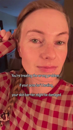 healthy skin barrier = healthy skin