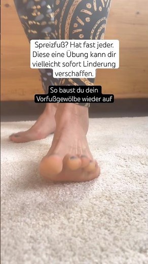Spreizfuß? Mache sofort diese Übung!!