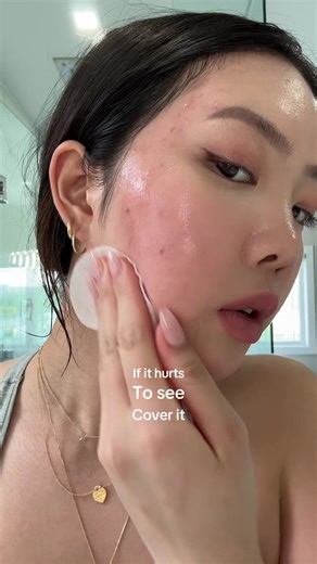 Cover Acne with Makeup: Tips for Healthy Skin