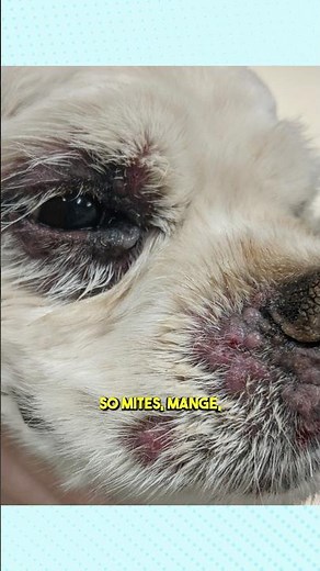 Here’s why Demodex can cause periocular dermatitis