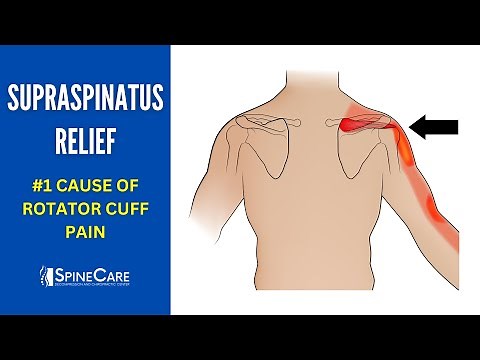 How to Fix Supraspinatus Pain FOR GOOD