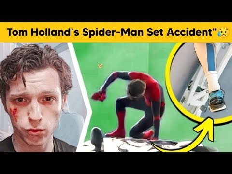 Tom Holland Injured in On-Set Accident While Filming Spider-Man 😲
