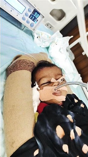 #ventilator #pt #picu #admi#children #tretment #given #hospital #pediatrics #doctor #nursing
