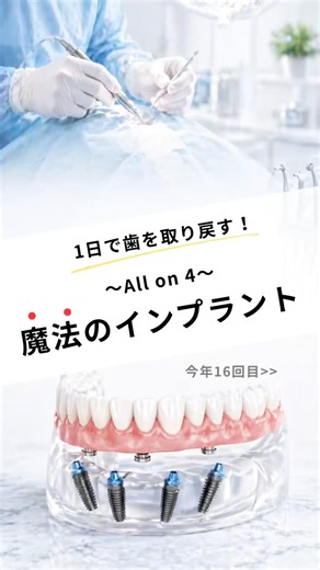 今年16回目のオールオン4のオペです！ #なかの歯科 #岡山歯医者 #インプラント治療 #オールオン4 #allon4