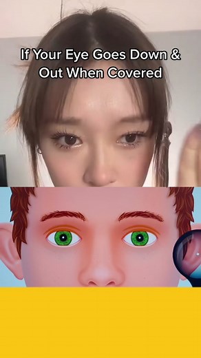 Understanding Binocular Vision Dysfunction Symptoms and Tests