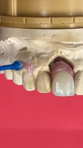 Sensitive case! | CEO Luke Kahng