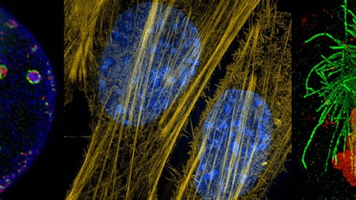 Super-resolution microscopes showcase the inner lives of cells