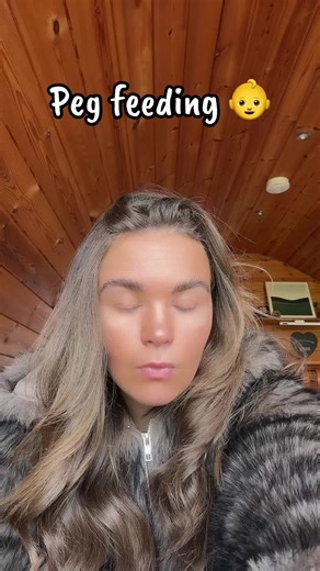 Understanding Peg Feeding: Advice for Parents