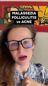 Malassezia (Pityrosporum) Folliculitis: The Acne That Isn’t Acne #folliculitis #acne #bodyacne