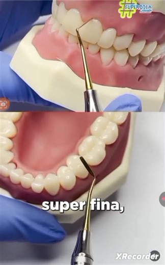 Composite instruments use during treatment of Dental health stainless steel CE.