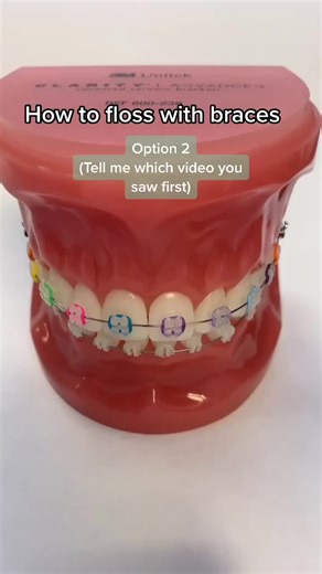 How to Floss with Braces using Special Floss Pick