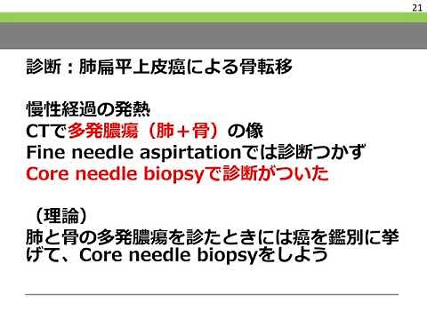 初心者向けの症例報告のやり方