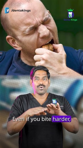 இரண்டாம் வகை பல் அடைப்பு உடைவது ஏன்? - Why class II filling breaks? | Dr.Karthikeyan | Denta Kings