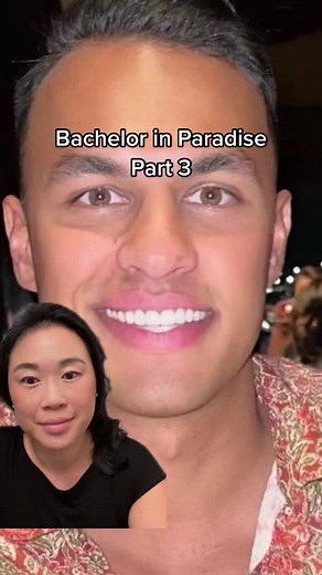 Dental Veneers: The Ultimate Guide to Achieving a Hollywood Smile