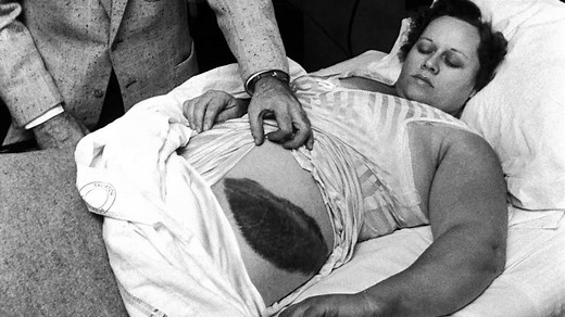 Extraordinary meteorite near-misses including woman who survived after being HIT