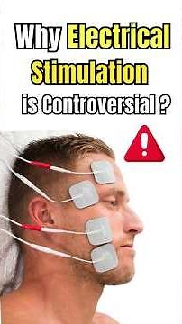 Why Electrical Stimulation Is CONTROVERSIAL in Bell’s Palsy ⚡🧠