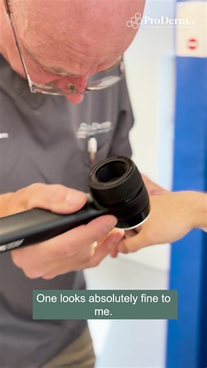 In this video, Dr Adam Friedmann explains the dermatoscope, a specialist instrument that allows us to examine moles, pigmentation and skin lesions in microscopic detail. It’s one of the most important tools in modern dermatology, and it’s used in every ProdermUK skin check. If you’ve noticed a changing mole or want a full, expert-led assessment, our clinics in Cheltenham, Harley Street, London and Birmingham are here to help. 👉 Tap the link in bio to book your skin check. #ProdermUK #SkinCheck 