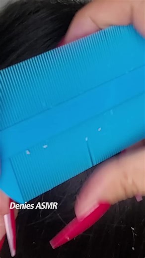 ASMR Dandruff Removal and Scalp Scratch Sounds Experience