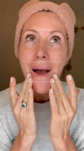 At home Microneedling, No Needles Required✨⁠💉❌ Licensed esthetician @jennifer_adell shares why she’s obsessed with our NEW Dermal Micro Points. A breakthrough formula that mimics the benefits of in office microneedling ✨ without the pain, cost, or downtime.⁠🤝 Infused with natural spicules that create 3 million microchannels in just 5 minutes, this collagen boosting gel helps visibly smooth fine lines, even skin texture, and supercharge ingredient absorption, all from the comfort of home!🥳 Pro