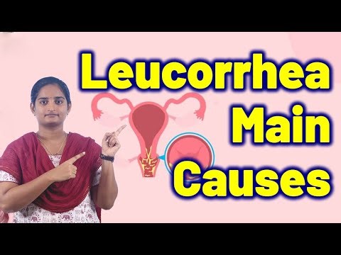 Main Causes of Leucorrhea in Women | White Discharge Treatment Cure Medicine | Gynaecology Women