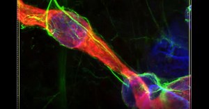 Imaging the brain at multiple size scales