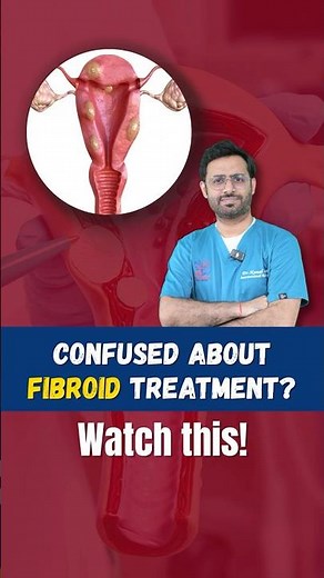 Do You Really Need Surgery for Fibroids? Complete Guide to Uterine Artery Embolisation (UAE)