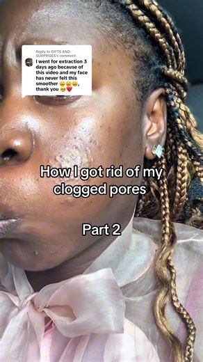 Get Rid of Clogged Pores: Part 2