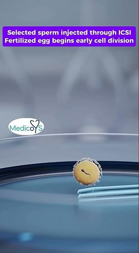 How Does IVF Work? | Complete IVF Process in 3D Medical Animation #shorts