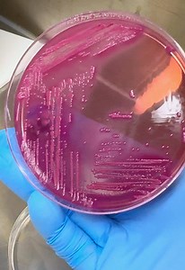 Laboratory day 🧫 #microbiology #ecoli #routine #tiktok #lab