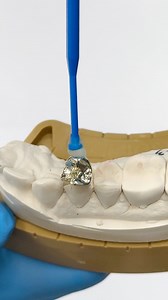 Gold Inlay/Onlay! Case from Dr. Leonard Anglis in Indiana! | Luke Kahng