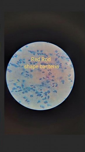 T.B Bacteria under Microscope