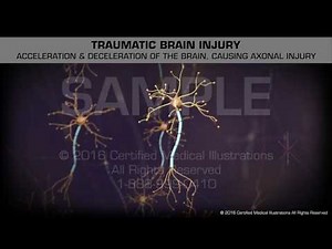 Traumatic Brain Injury