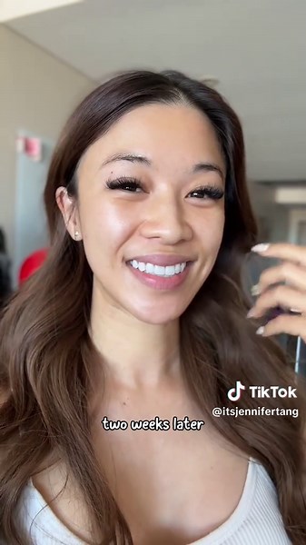 Transform Your Skin with Salmon DNA Treatment