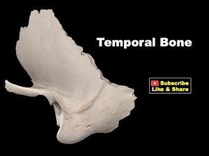 Osteology of Head & Neck - Temporal Bone #Anatomy #mbbs #bds #education