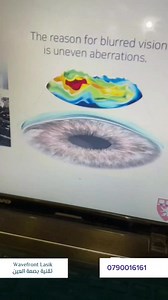 1.5K views · 12 reactions | تقنية بصمة العين / Wavefront Lasik د. عمر الزعبي / استشاري طب وجراحة العيون للمزيد من الاستفسار والمواعيد 0790016161 ‏#wavefronlasikt #بصمةالعين #أطباءالعیون #أطباء_الشامي #eyesurgery #lasik #eyelaser #visioncorrection #eyeshealth #shamieye #shamieye | الشامي للعيون - العقبة | Facebook