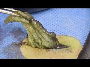 Dr. Lee Geoff Butler Enilsa MrPopZit 🌝 Professional pedicure process【Xue Yidao】🌝 211204