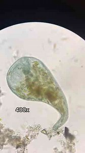 A Stentor Under the Microscope