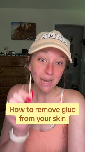 How to Remove Nail Glue from Skin: Simple Tips