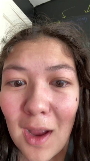 this is so so gross #tw #pimple #gross | pimples videos