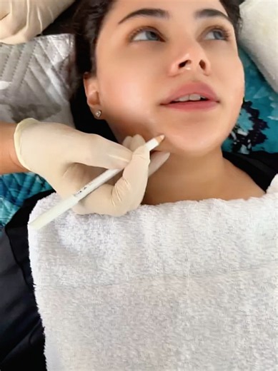 Skinny • Aesthetics • Beauty HiFu Treatment ✨ • Tightens and lifts loose skin • Stimulates natural collagen production • Defines the jawline and contours the face • Helps reduce the appearance of fine lines & wrinkles • Can assist with body contouring and stubborn fat areas • Non-surgical with little to no downtime Perfect for clients wanting a firmer, lifted, more sculpted look without s*rgery 💫 R2000 Face & Neck Shay : 067 786 8989 Based in Benoni #SAMA28 #vibes #fyp #foryoupage #fypシ゚