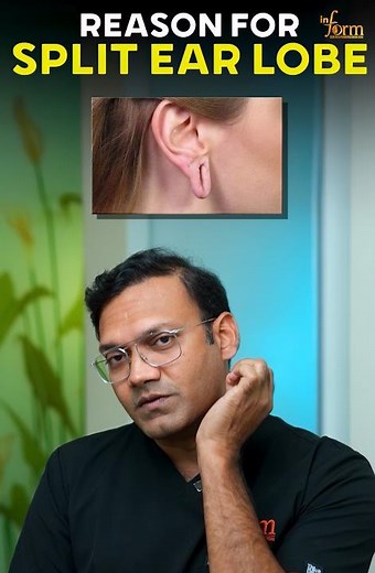 Reason for Split Ear Lobe | Common Causes Explained by Doctor | #EarInjury #EarlobeSurgery