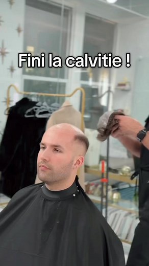 La perte de cheveux n'est pas une fatalité. 📍36 bis rue du Faubourg du Temple, Paris 11e 📲Envoyez-nous un message et commencez votre transformation dès aujourd'hui | Complément Capillaire Paris