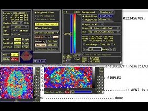 PsychoPhysiological Interactions, or PPI (aka Context-Dependent Correlations