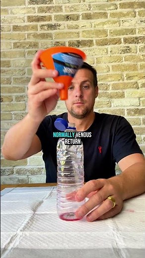 Cardiac Tamponade Explained in 60 Seconds | Beck’s Triad & Pathophysiology for Clinicians