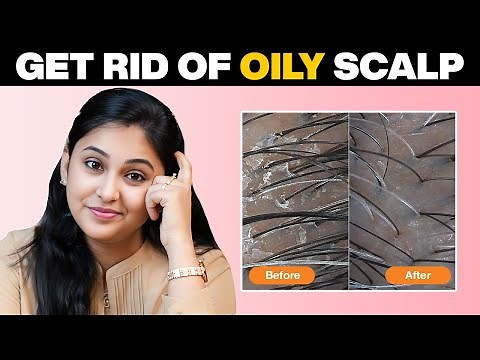 How to Get Rid of an Oily Scalp: Dermatologist-Approved Solutions!