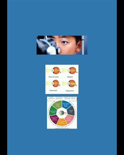 myopia clinic. #vision #myopiaawareness #myopiamanagement #myopie
